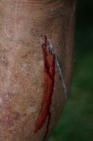 FITZ AND FRIENDS